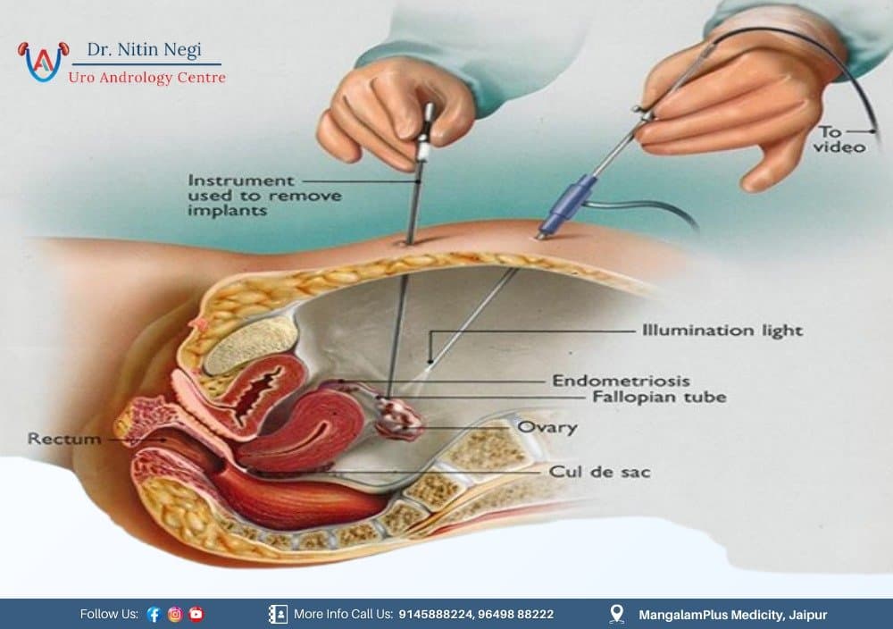Female Urology