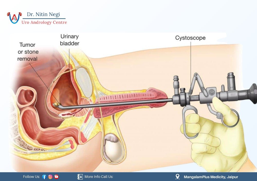 Best Urologist in Jaipur