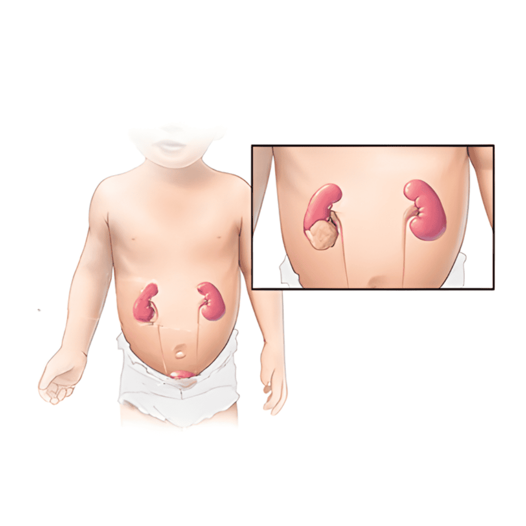 pediatric urology treatment in jaipur child urinary care